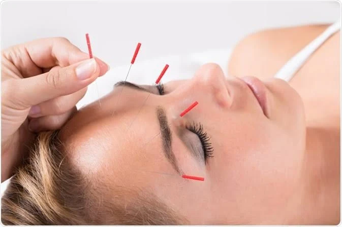 Sri Sanjeevi Accupuncture Clinic & Accupunture Training center in Madurai - Madurai Ads